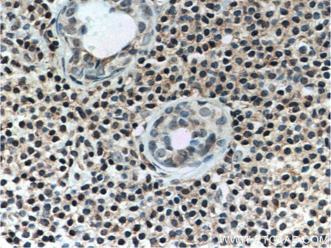 TWIST2 Antibody in Immunohistochemistry (Paraffin) (IHC (P))