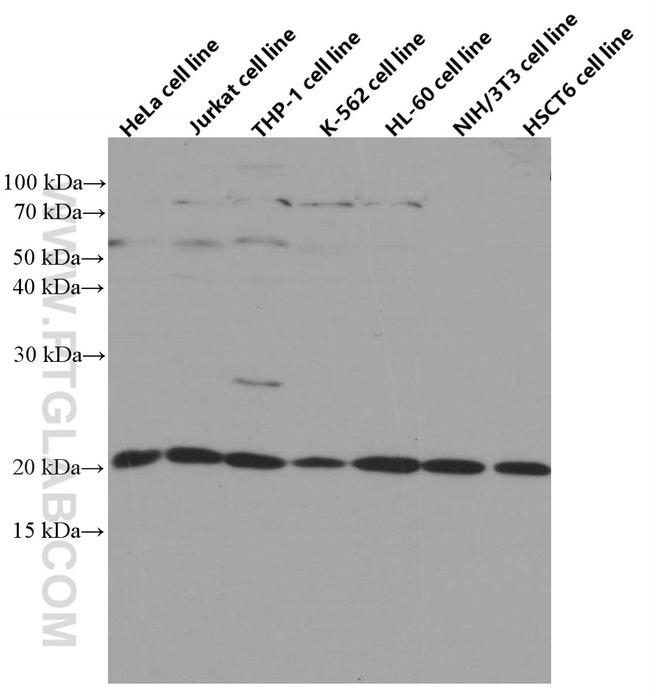 TWIST2 Antibody in Western Blot (WB)