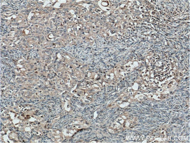 TWIST2 Antibody in Immunohistochemistry (Paraffin) (IHC (P))