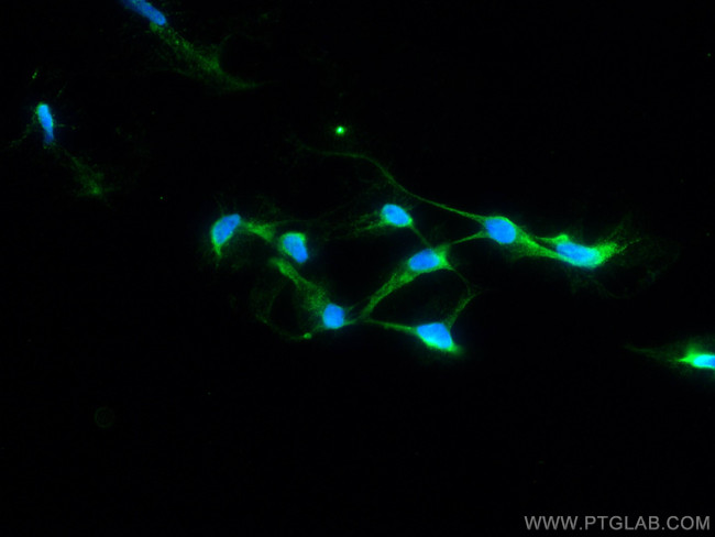 STAT1 Antibody in Immunocytochemistry (ICC/IF)