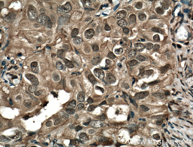 STAT1 Antibody in Immunohistochemistry (Paraffin) (IHC (P))