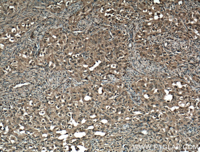 STAT1 Antibody in Immunohistochemistry (Paraffin) (IHC (P))