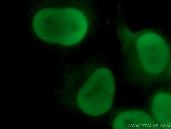 XRCC5 Antibody in Immunocytochemistry (ICC/IF)