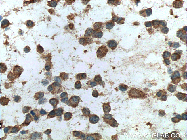 FMR1 Antibody in Immunohistochemistry (Paraffin) (IHC (P))