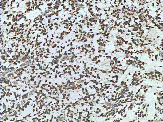 FMR1 Antibody in Immunohistochemistry (Paraffin) (IHC (P))