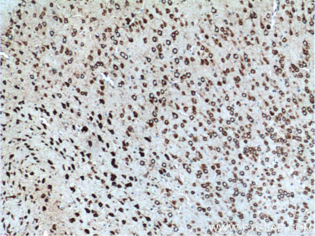 FMR1 Antibody in Immunohistochemistry (Paraffin) (IHC (P))