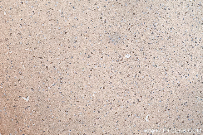 ARC Antibody in Immunohistochemistry (Paraffin) (IHC (P))