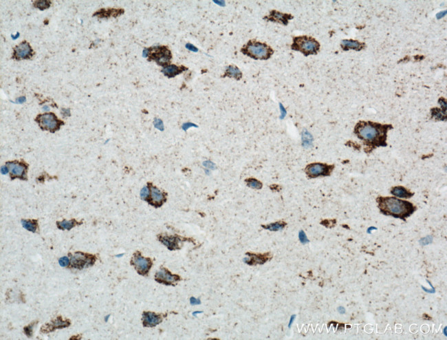 ARC Antibody in Immunohistochemistry (Paraffin) (IHC (P))