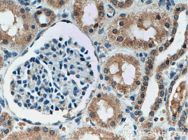 YME1L1 Antibody in Immunohistochemistry (Paraffin) (IHC (P))