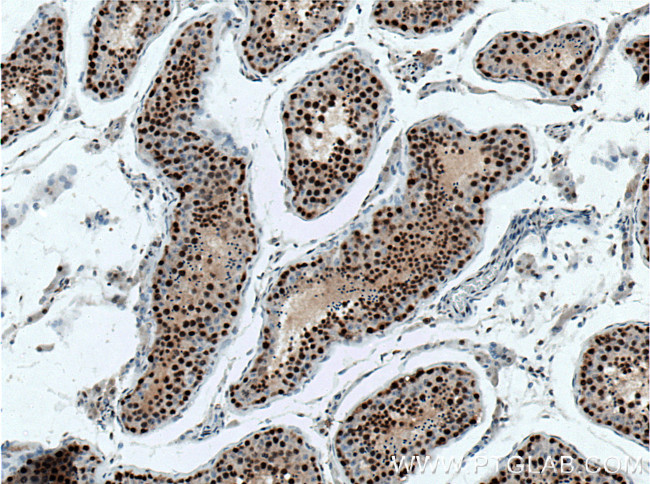 NHEJ1 Antibody in Immunohistochemistry (Paraffin) (IHC (P))