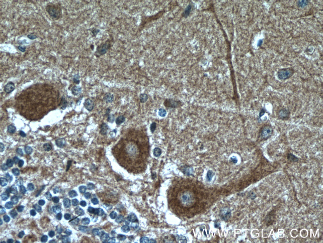 Huntingtin Antibody in Immunohistochemistry (Paraffin) (IHC (P))