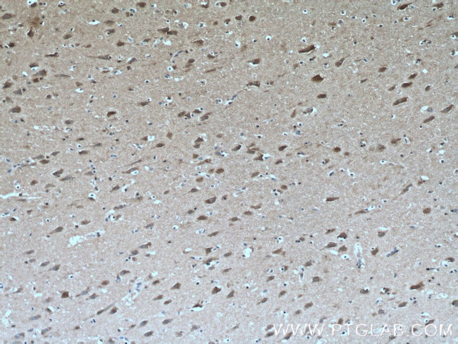 Huntingtin Antibody in Immunohistochemistry (Paraffin) (IHC (P))