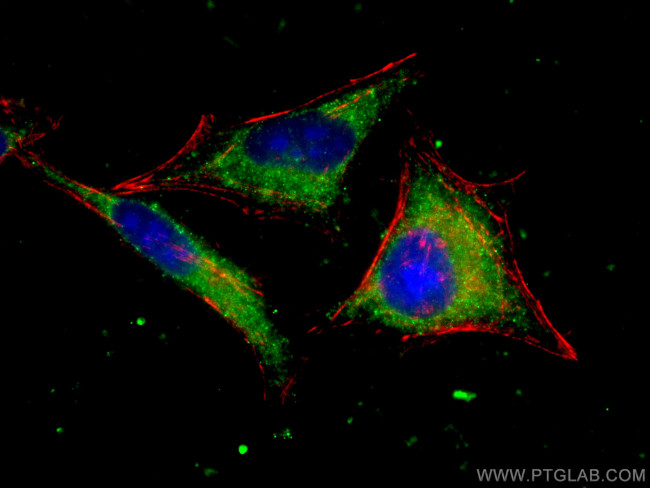 BCL10 Antibody in Immunocytochemistry (ICC/IF)