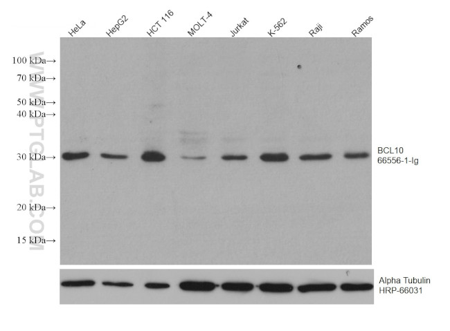 BCL10 Antibody in Western Blot (WB)