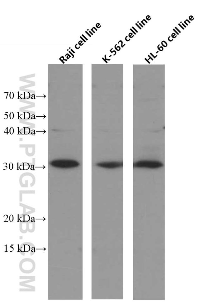 BCL10 Antibody in Western Blot (WB)