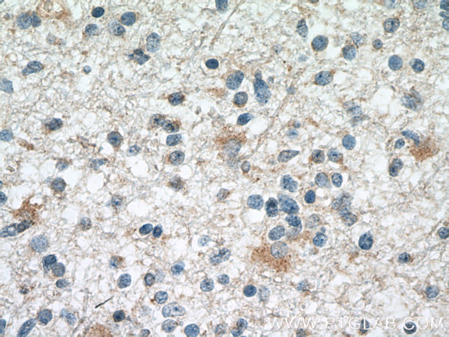 SMAD1 Antibody in Immunohistochemistry (Paraffin) (IHC (P))