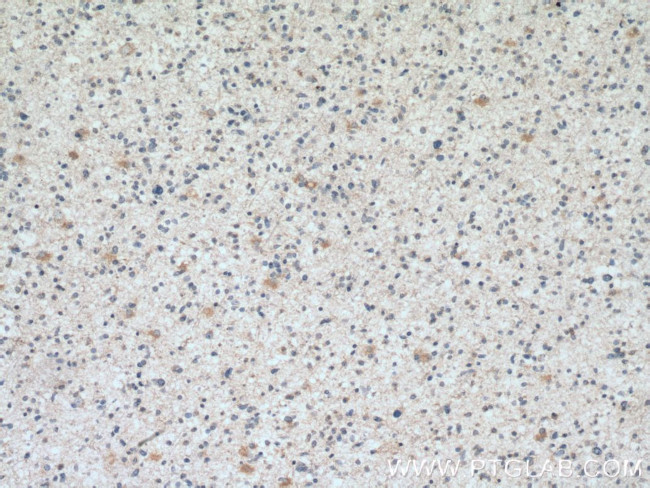 SMAD1 Antibody in Immunohistochemistry (Paraffin) (IHC (P))