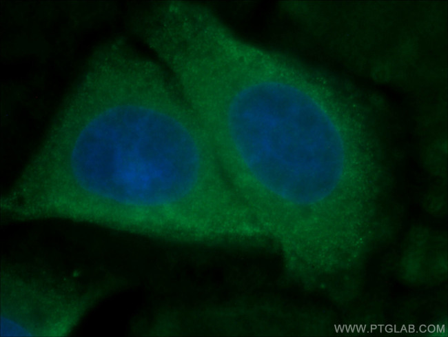 ATF6 Antibody in Immunocytochemistry (ICC/IF)