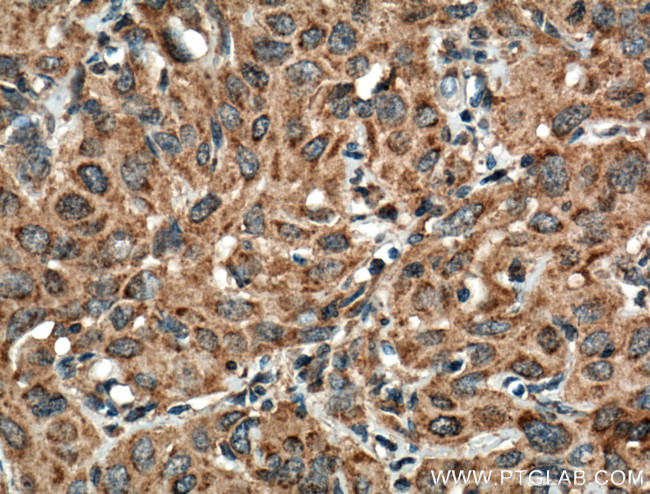 ATF6 Antibody in Immunohistochemistry (Paraffin) (IHC (P))