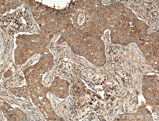 ATF6 Antibody in Immunohistochemistry (Paraffin) (IHC (P))