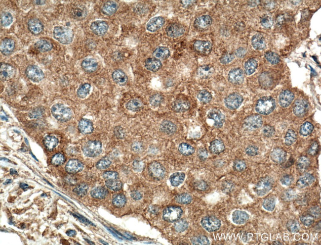 ATF6 Antibody in Immunohistochemistry (Paraffin) (IHC (P))