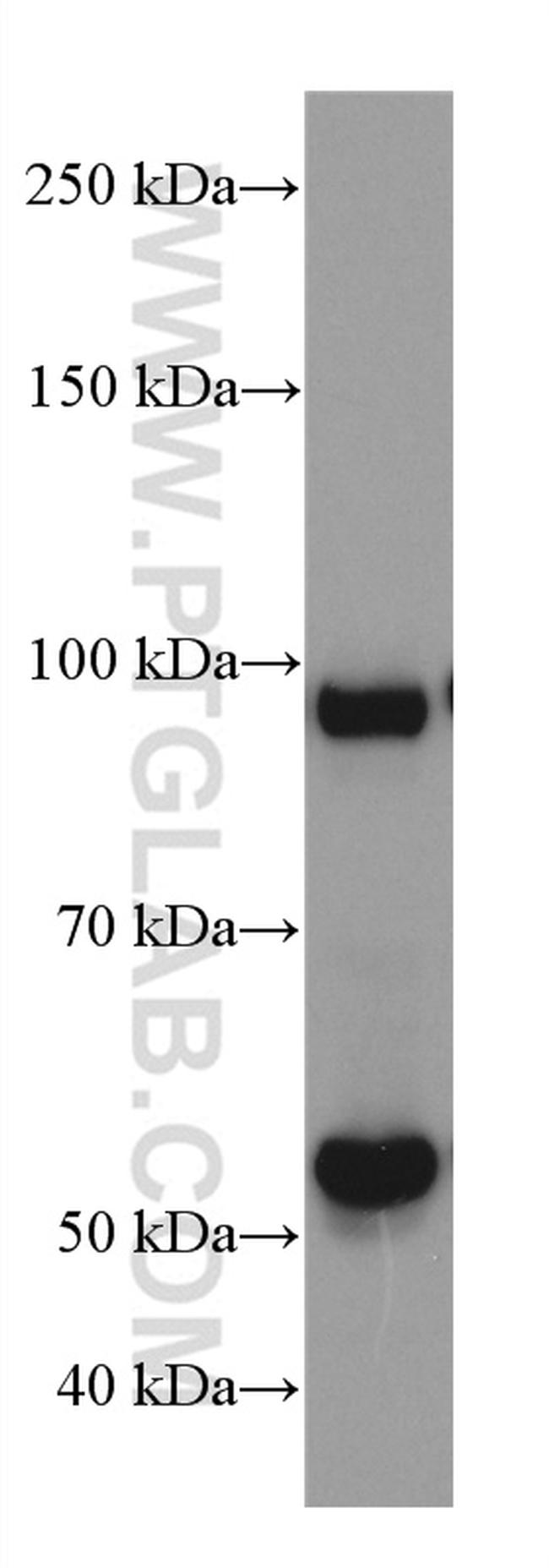 ATF6 Antibody in Western Blot (WB)