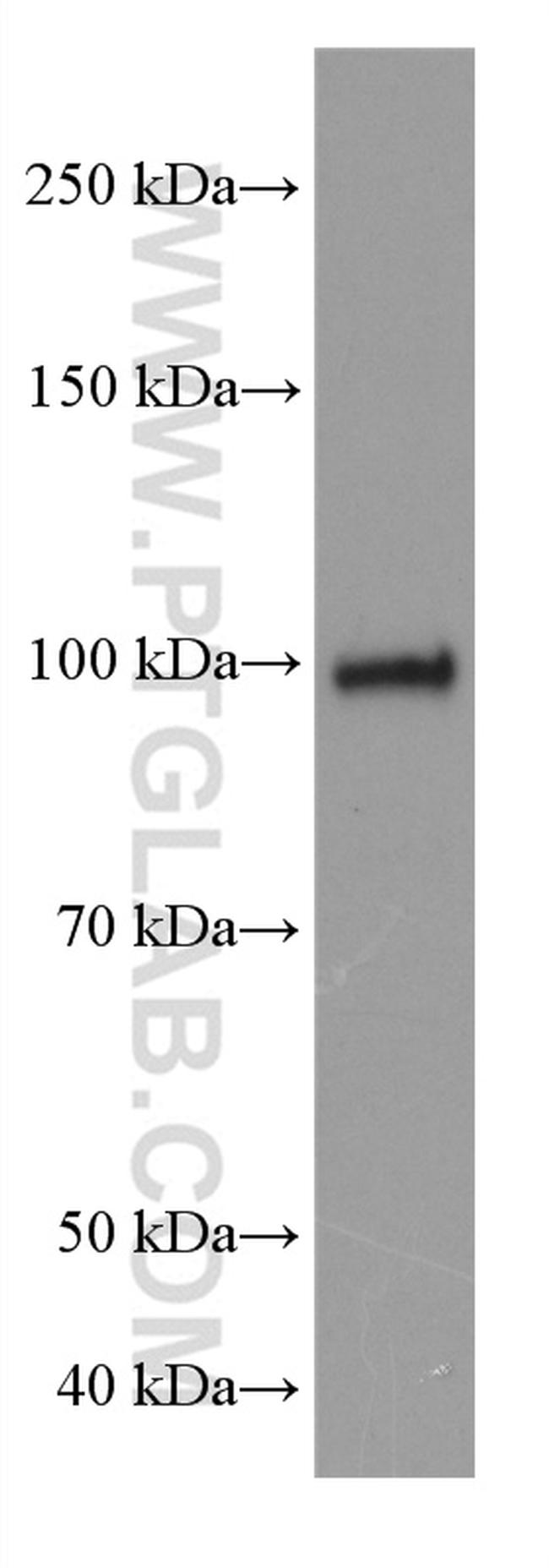 ATF6 Antibody in Western Blot (WB)