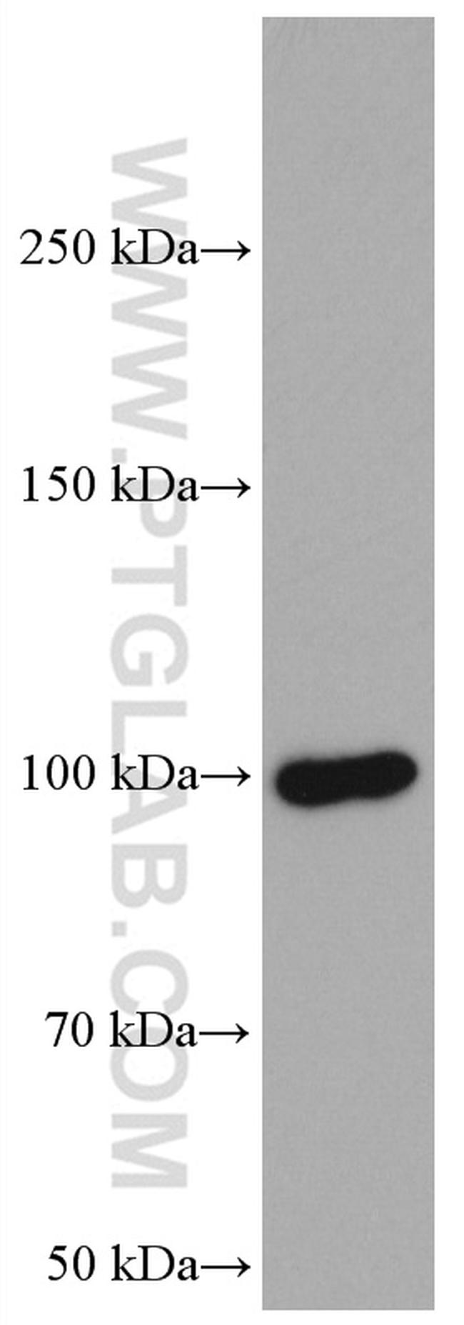 ATF6 Antibody in Western Blot (WB)