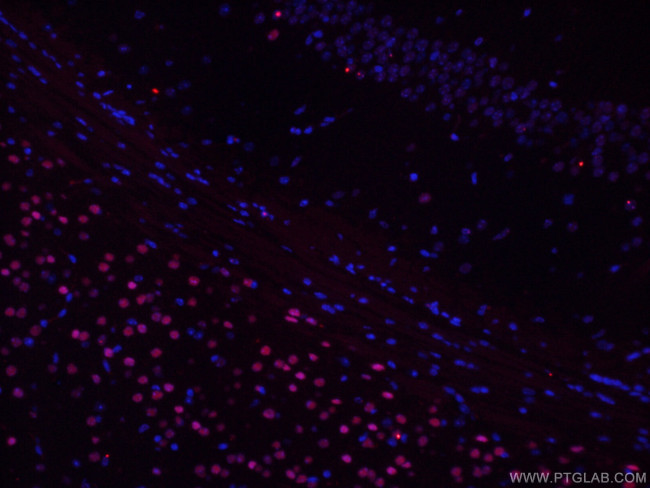 TBR1 Antibody in Immunohistochemistry (PFA fixed) (IHC (PFA))