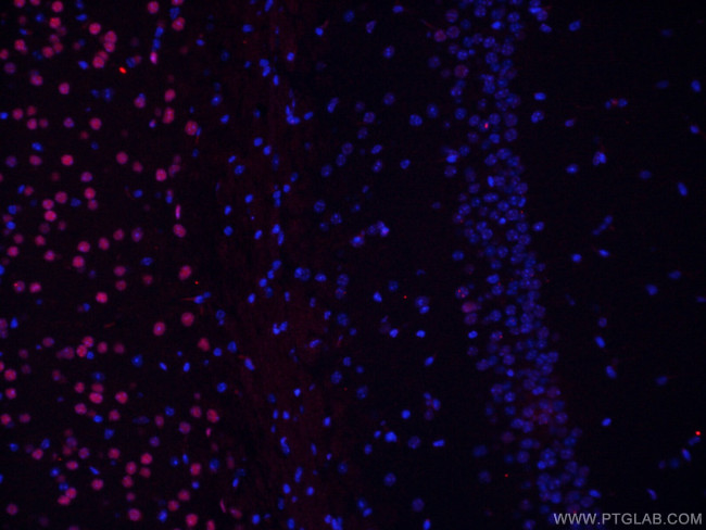 TBR1 Antibody in Immunohistochemistry (PFA fixed) (IHC (PFA))