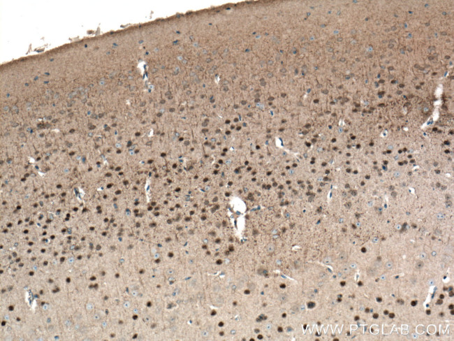 TBR1 Antibody in Immunohistochemistry (Paraffin) (IHC (P))