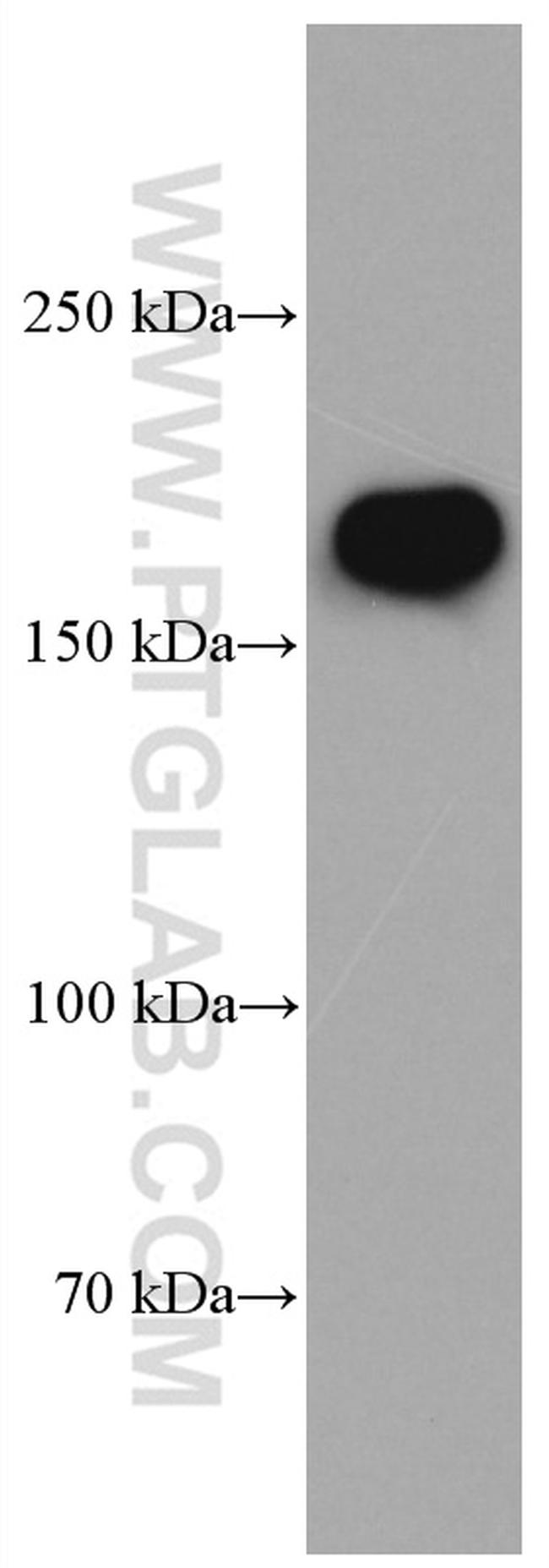 GRIN2B Antibody in Western Blot (WB)