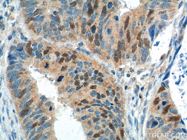 GMNN Antibody in Immunohistochemistry (Paraffin) (IHC (P))