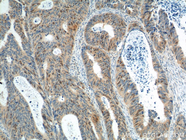 GMNN Antibody in Immunohistochemistry (Paraffin) (IHC (P))