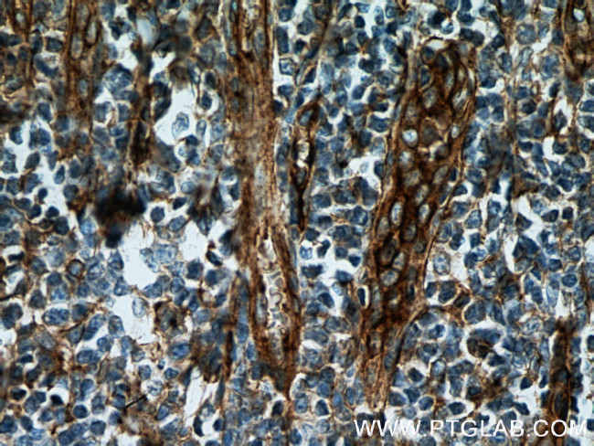 CD151 Antibody in Immunohistochemistry (Paraffin) (IHC (P))