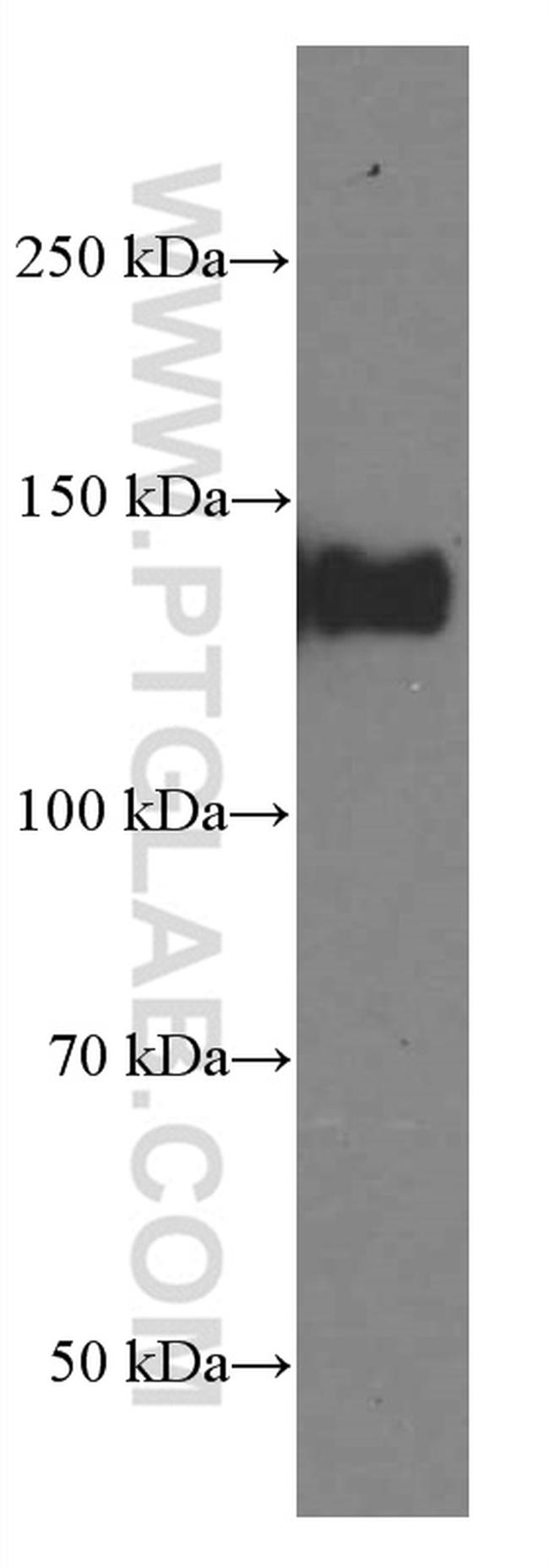 LATS1 Antibody in Western Blot (WB)