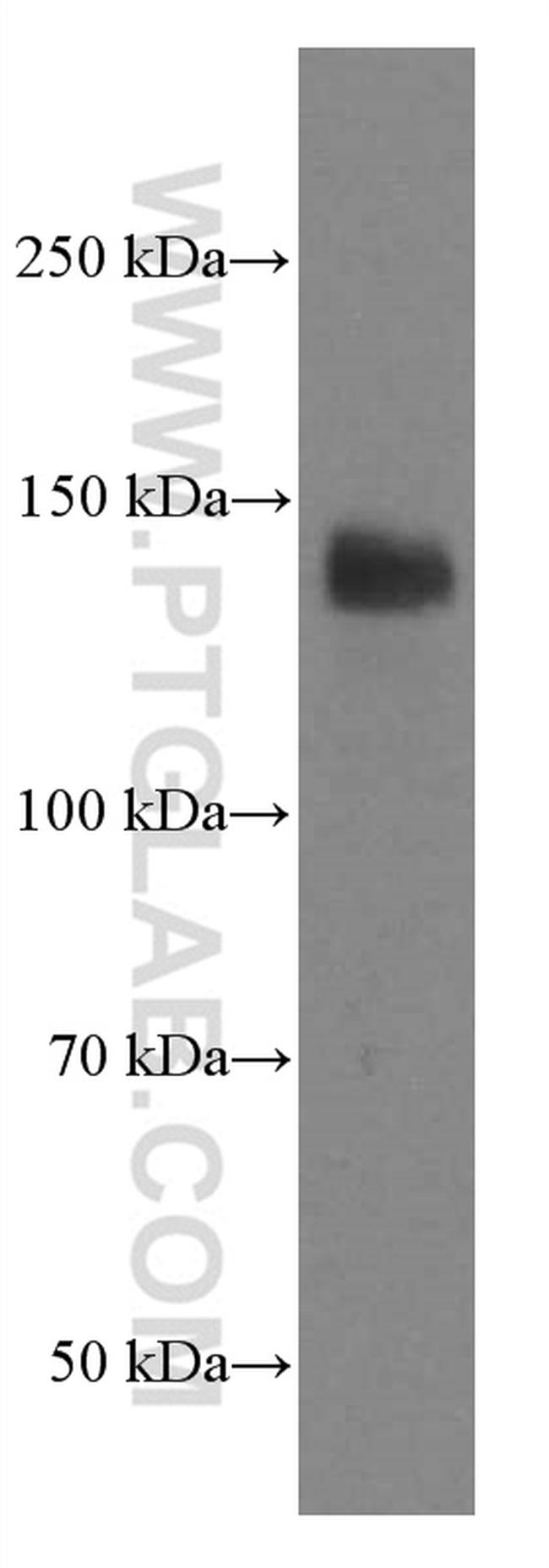 LATS1 Antibody in Western Blot (WB)