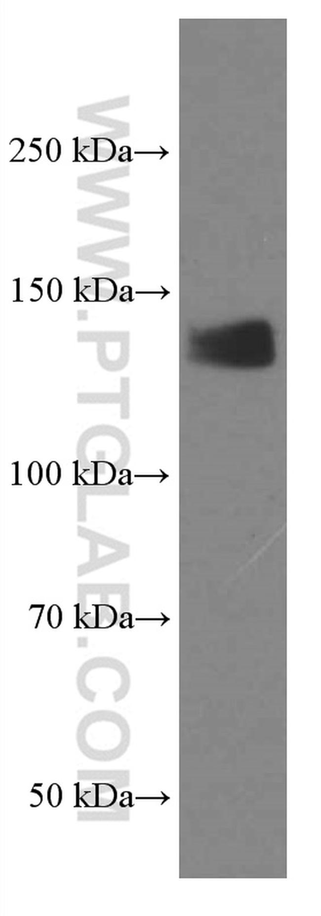 LATS1 Antibody in Western Blot (WB)