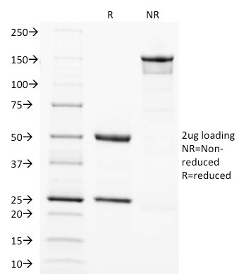 SOX2 (Embryonic Stem Cell Marker) Antibody in SDS-PAGE (SDS-PAGE)