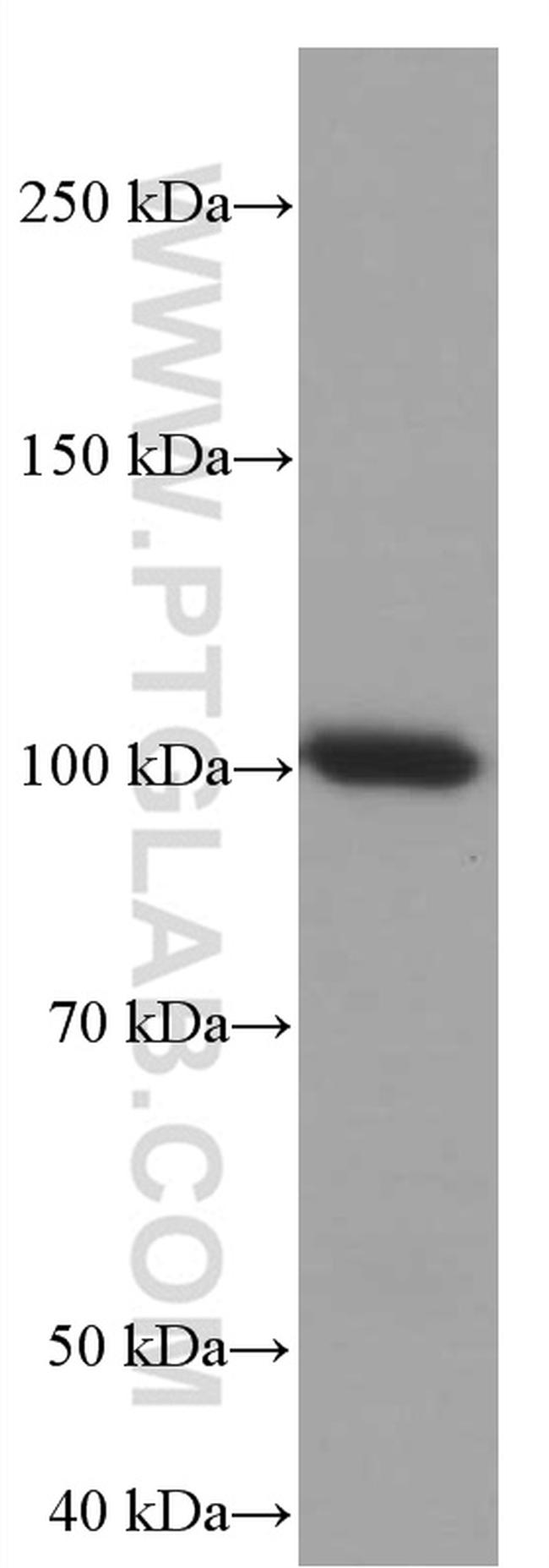 TLR5 Antibody in Western Blot (WB)