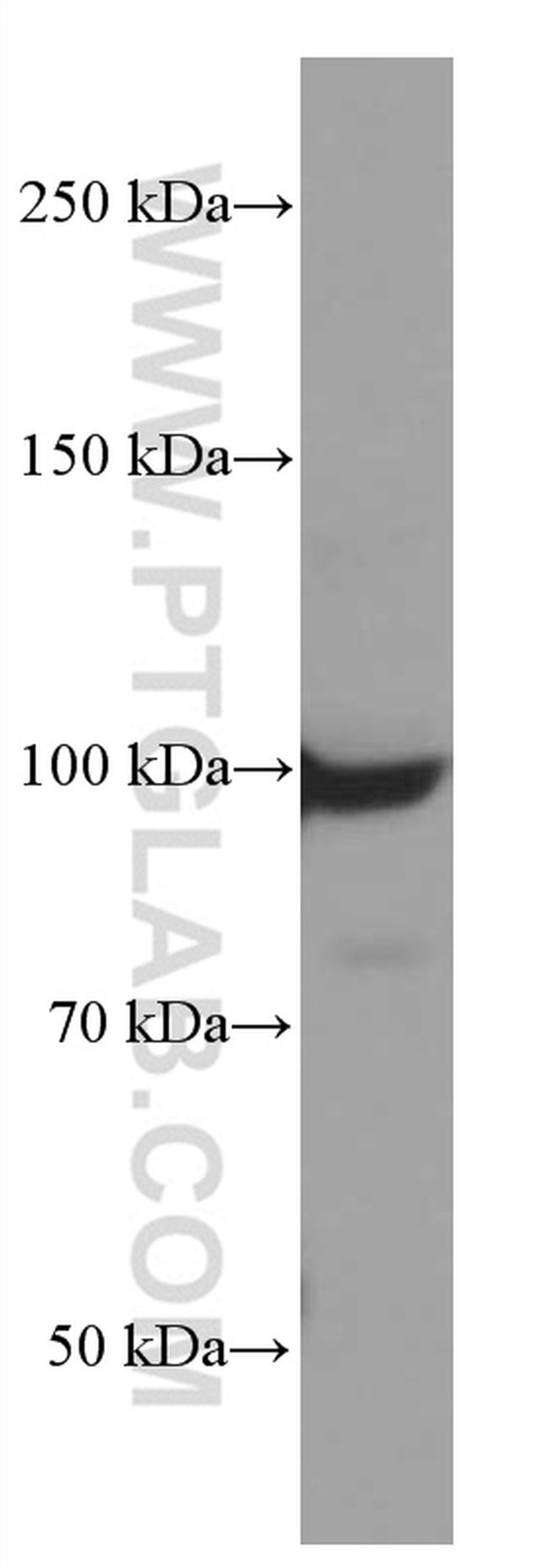 TLR5 Antibody in Western Blot (WB)