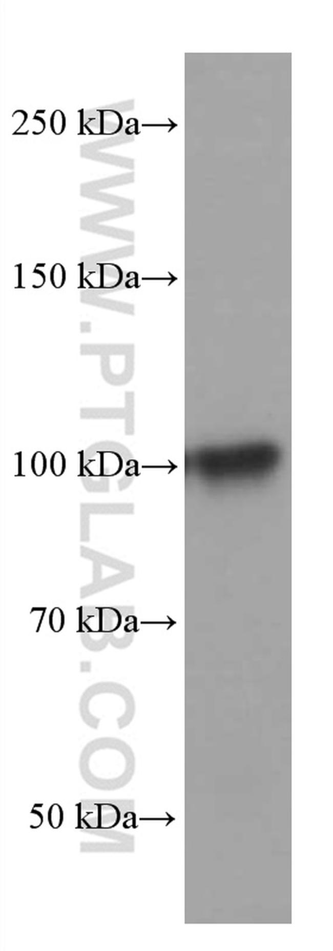 TLR5 Antibody in Western Blot (WB)