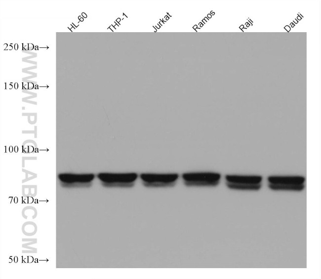 CIN85 Antibody in Western Blot (WB)