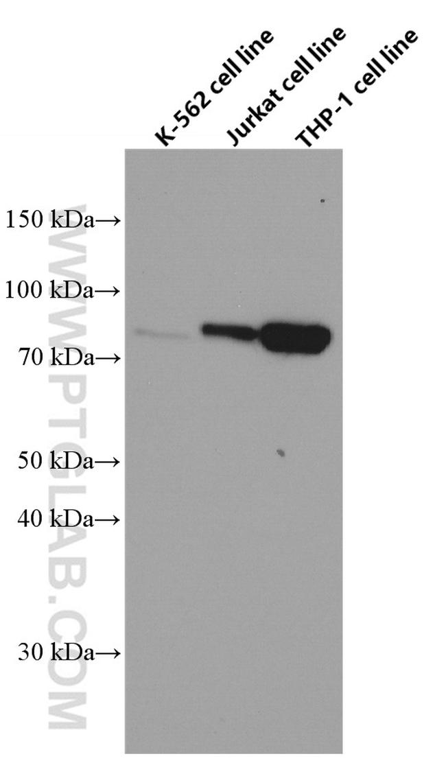 CIN85 Antibody in Western Blot (WB)