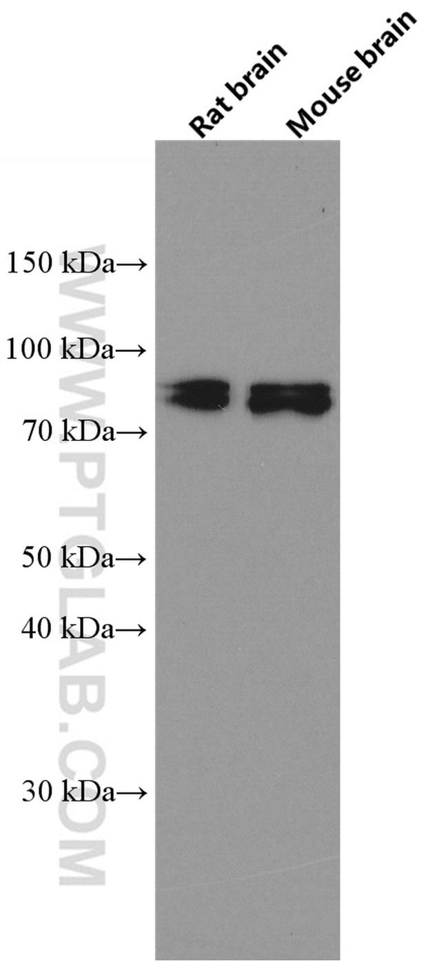 CIN85 Antibody in Western Blot (WB)