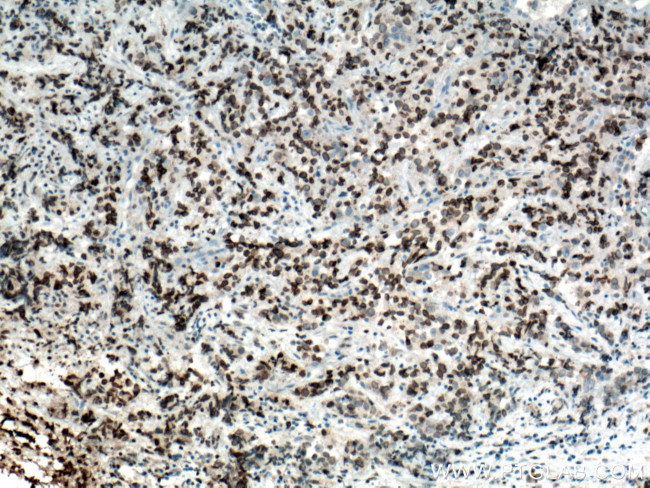 NUP62 Antibody in Immunohistochemistry (Paraffin) (IHC (P))