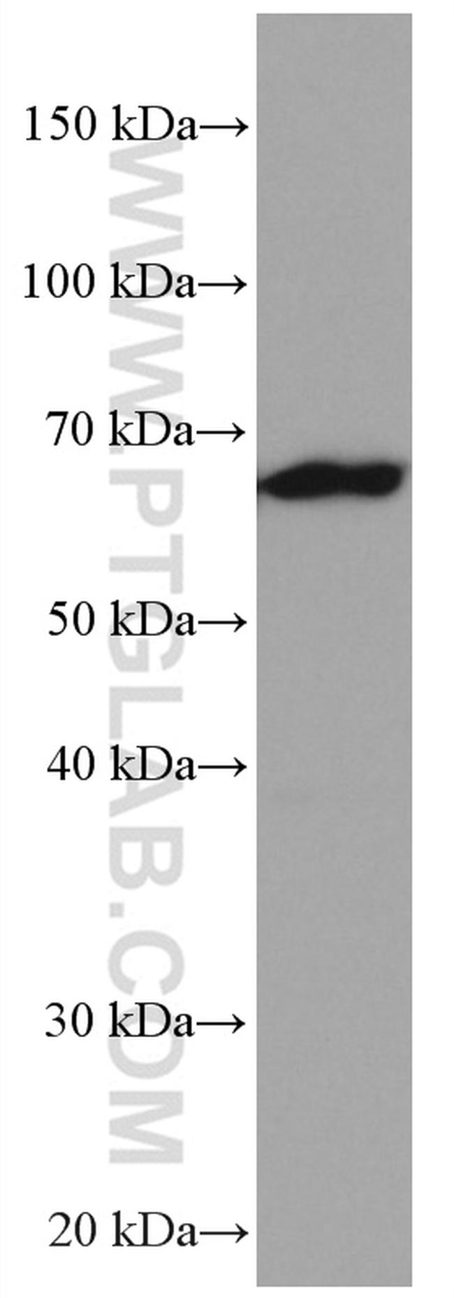 NUP62 Antibody in Western Blot (WB)