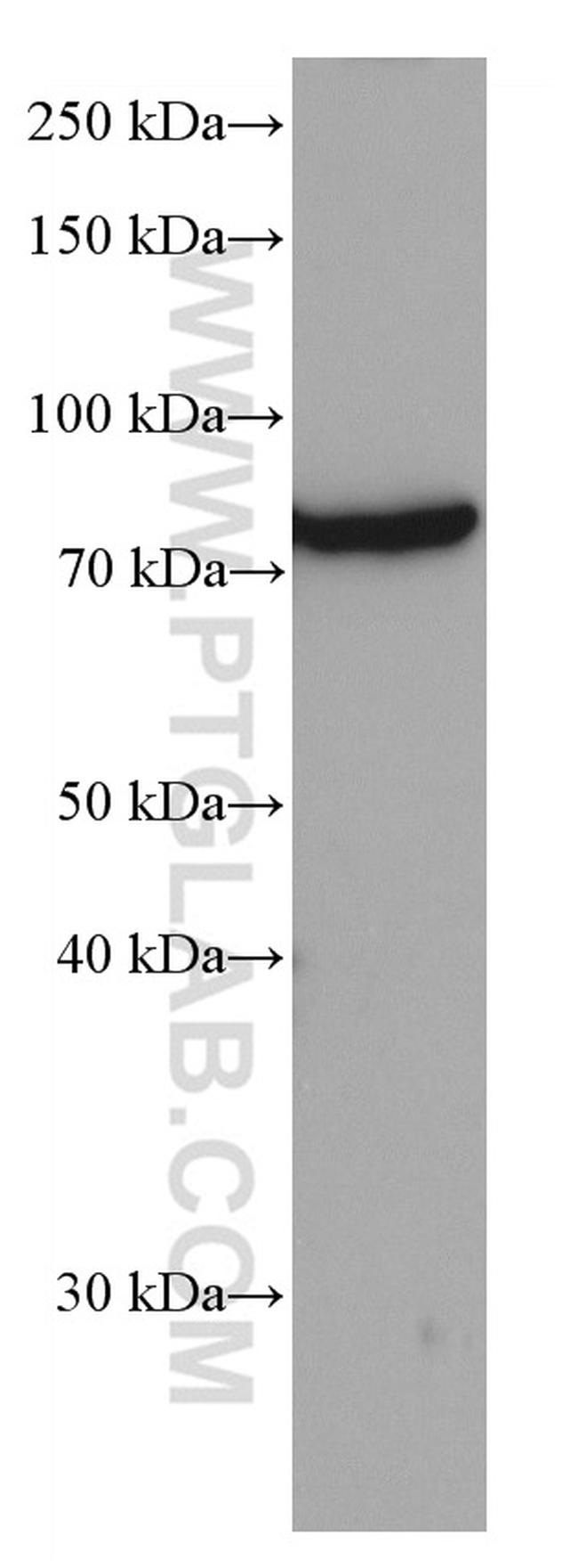 GRP78/BIP Antibody in Western Blot (WB)