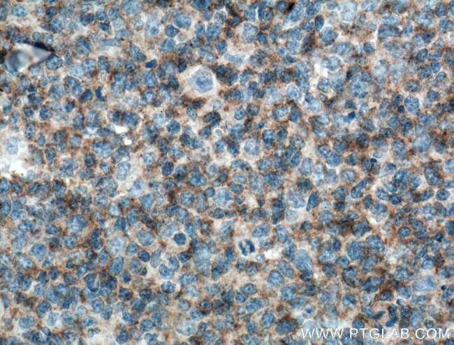 c-Cbl Antibody in Immunohistochemistry (Paraffin) (IHC (P))