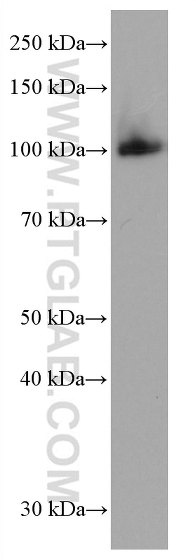 c-Cbl Antibody in Western Blot (WB)